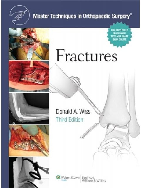 MTOS : FRACTURES 3E CB