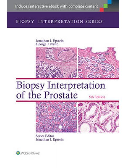 BIOPSY INTERPRETATION OF THE PROSTATE  HC