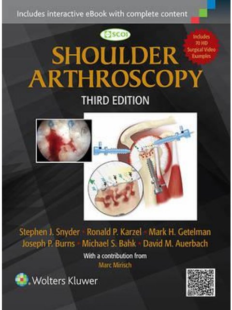 SHOULDER ARTHROSCOPY HC