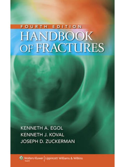 HANDBOOK OF FRACTURES PB