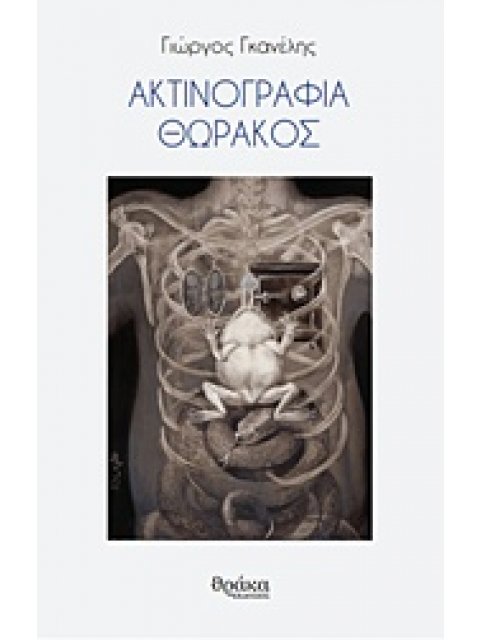 ΑΚΤΙΝΟΓΡΑΦΙΑ ΘΩΡΑΚΟΣ