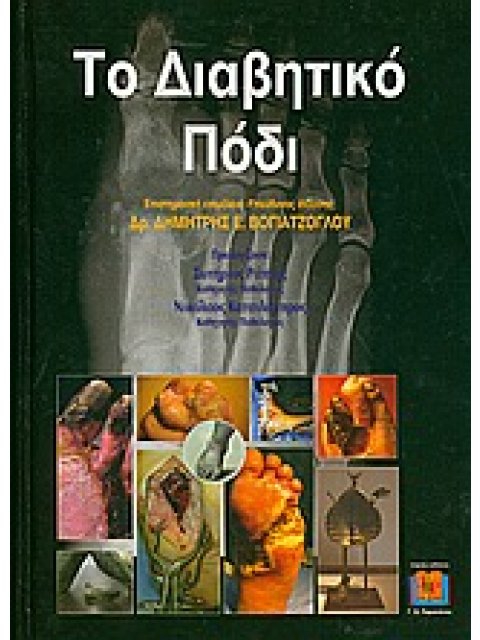 ΤΟ ΔΙΑΒΗΤΙΚΟ ΠΟΔΙ