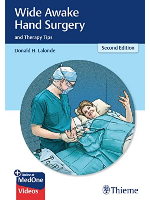 Wide Awake Hand Surgery and Therapy Tips