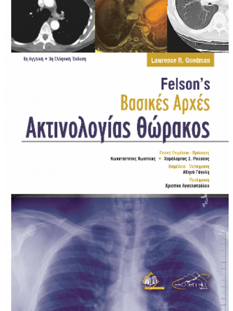 ΒΑΣΙΚΕΣ ΑΡΧΕΣ ΑΚΤΙΝΟΛΟΓΙΑΣ ΘΩΡΑΚΟΣ