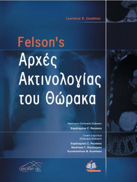 FELSON'S ΑΡΧΕΣ ΑΚΤΙΝΟΒΟΛΙΑΣ ΤΟΥ ΘΩΡΑΚΑ