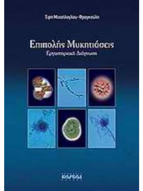 ΕΠΙΠΟΛΗΣ ΜΥΚΗΤΙΑΣΕΙΣ ΕΡΓΑΣΤΗΡΙΑΚΗ ΔΙΑΓΝΩΣΗ